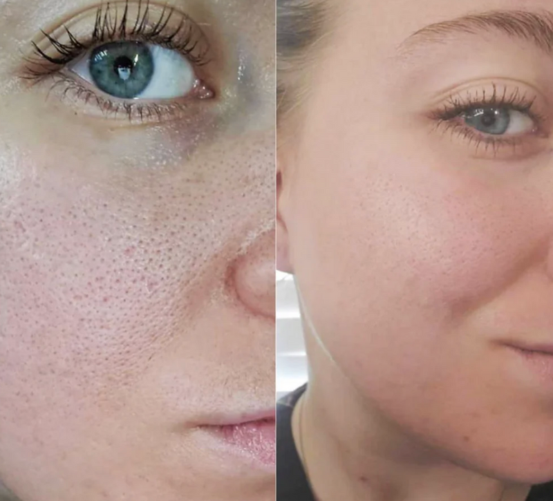 <p><strong>Begeistert</strong></p>