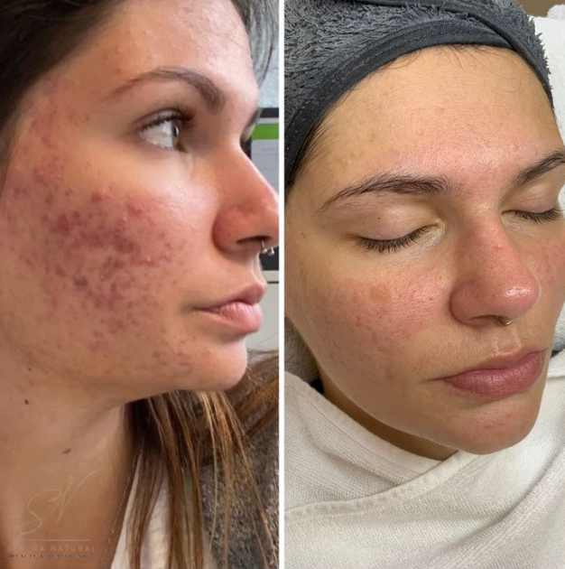 <p>Kaufe es wieder! :)</p>