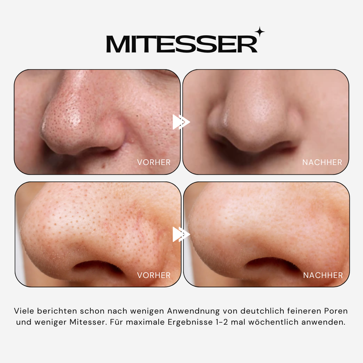 RiceCare™ Peel Serum