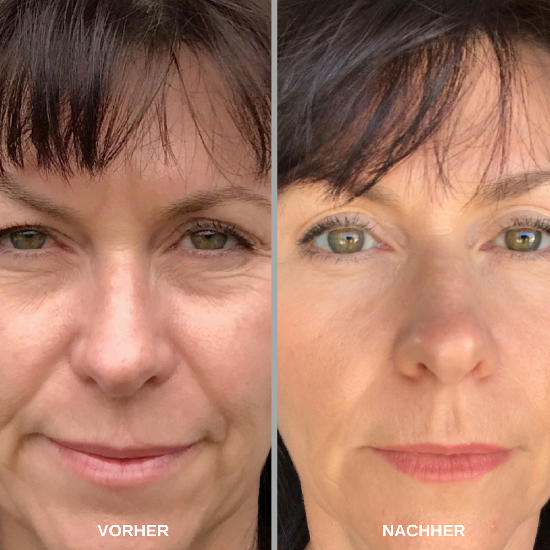 ReSkin™ Overnight Pad