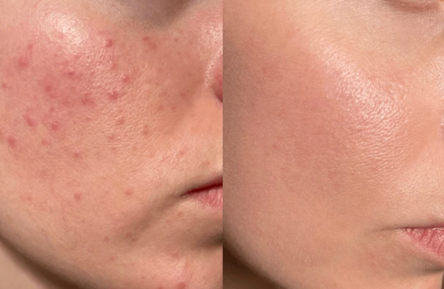 <p>Endlich was das hilft!</p>