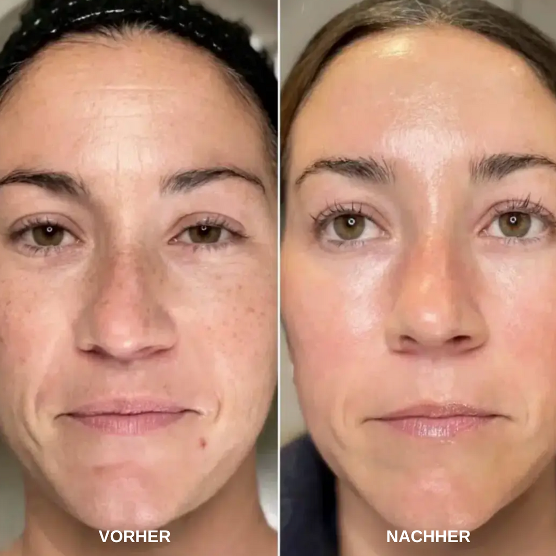 ReSkin™ Overnight Pad