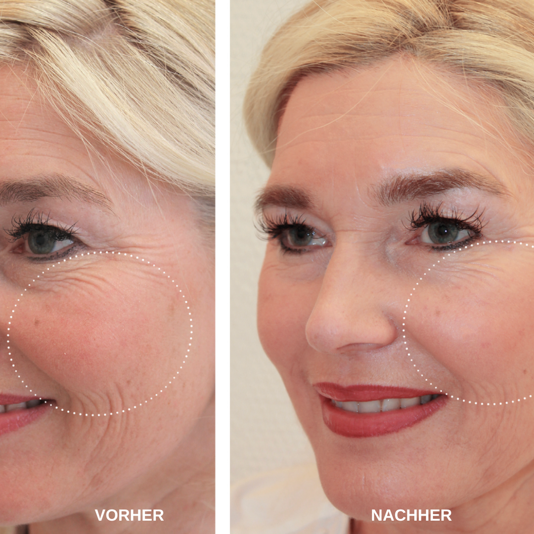 ReSkin™ Overnight Pad