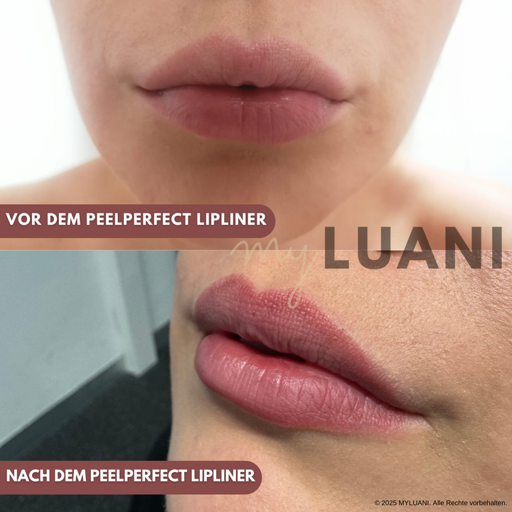 PeelPerfect™ Lipliner-Tattoo | Das Original