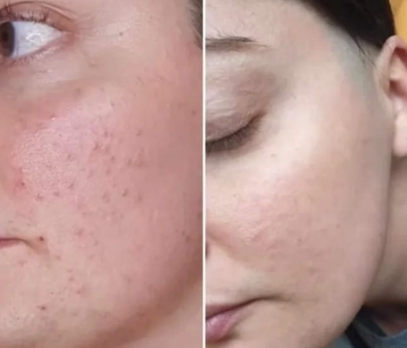 <p><strong>Liebe das Bundle</strong></p>