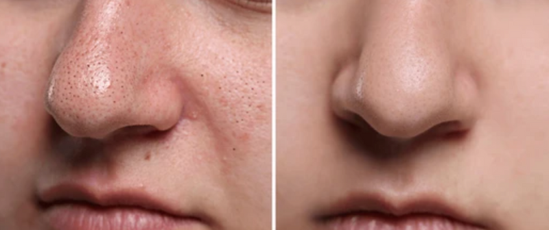 <p><strong>Wooow</strong></p>