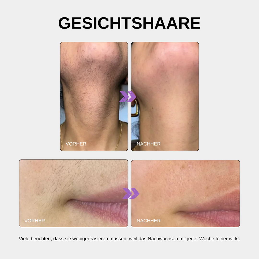 AfterGlow™ Haarwuchs-Reduzierendes Serum
