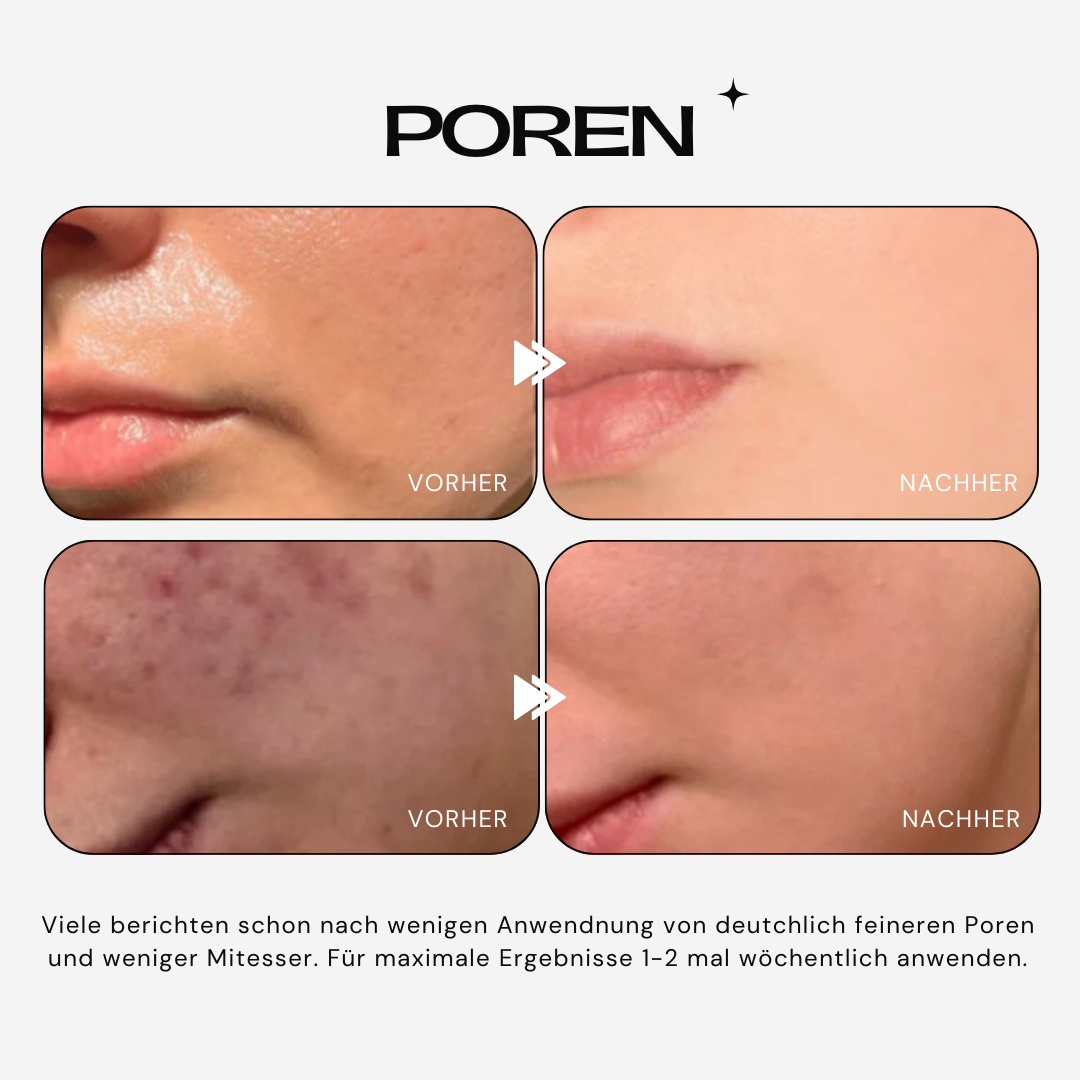 RiceCare™ Peel Serum Duo