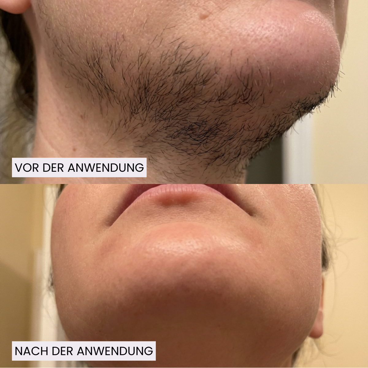 AfterGlow™ Haar-Stop Serum