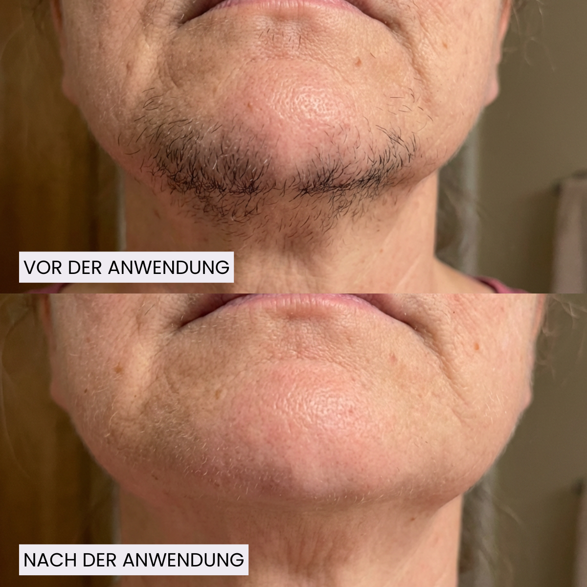 AfterGlow™ Haar-Stop Serum