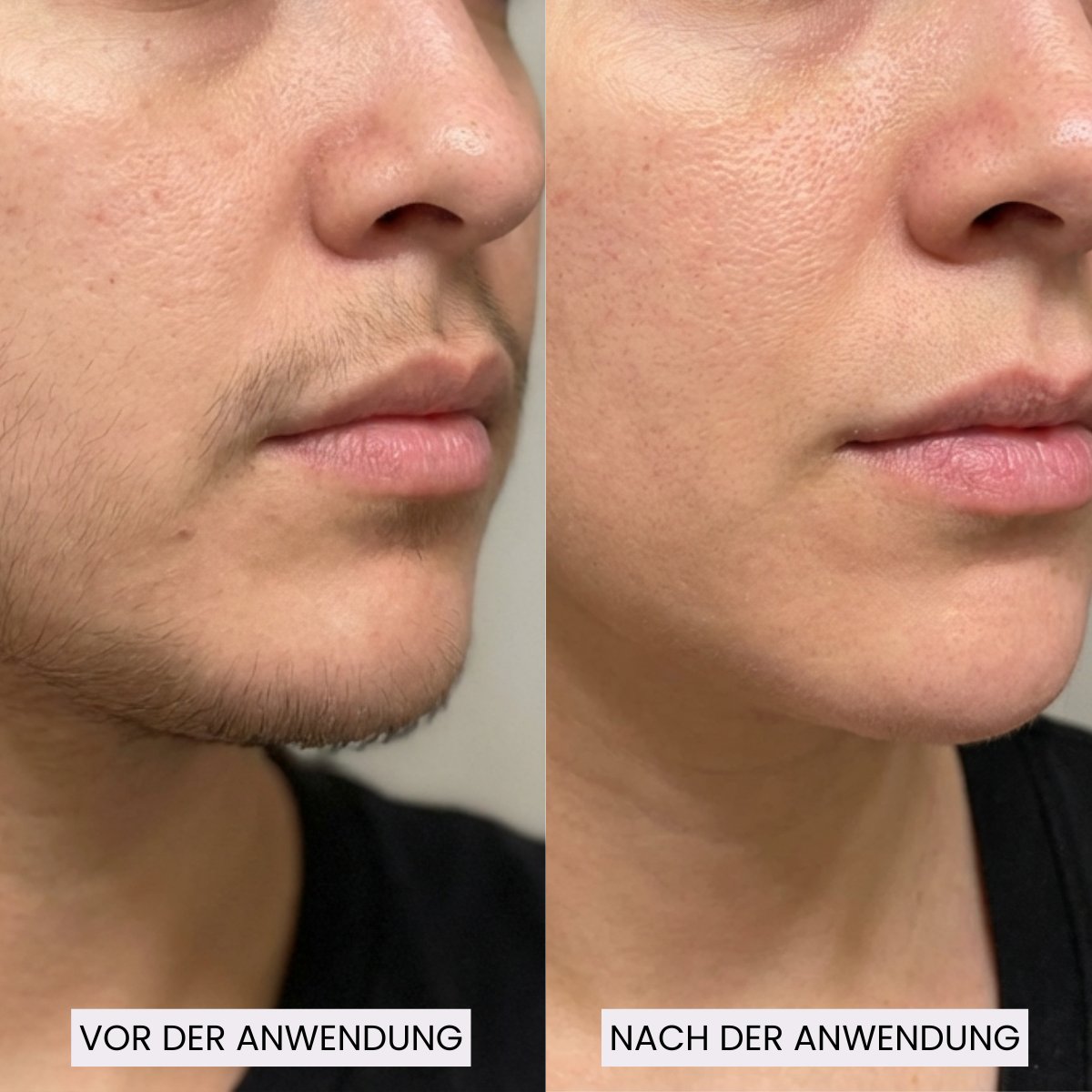 AfterGlow™ Haar-Stop Serum