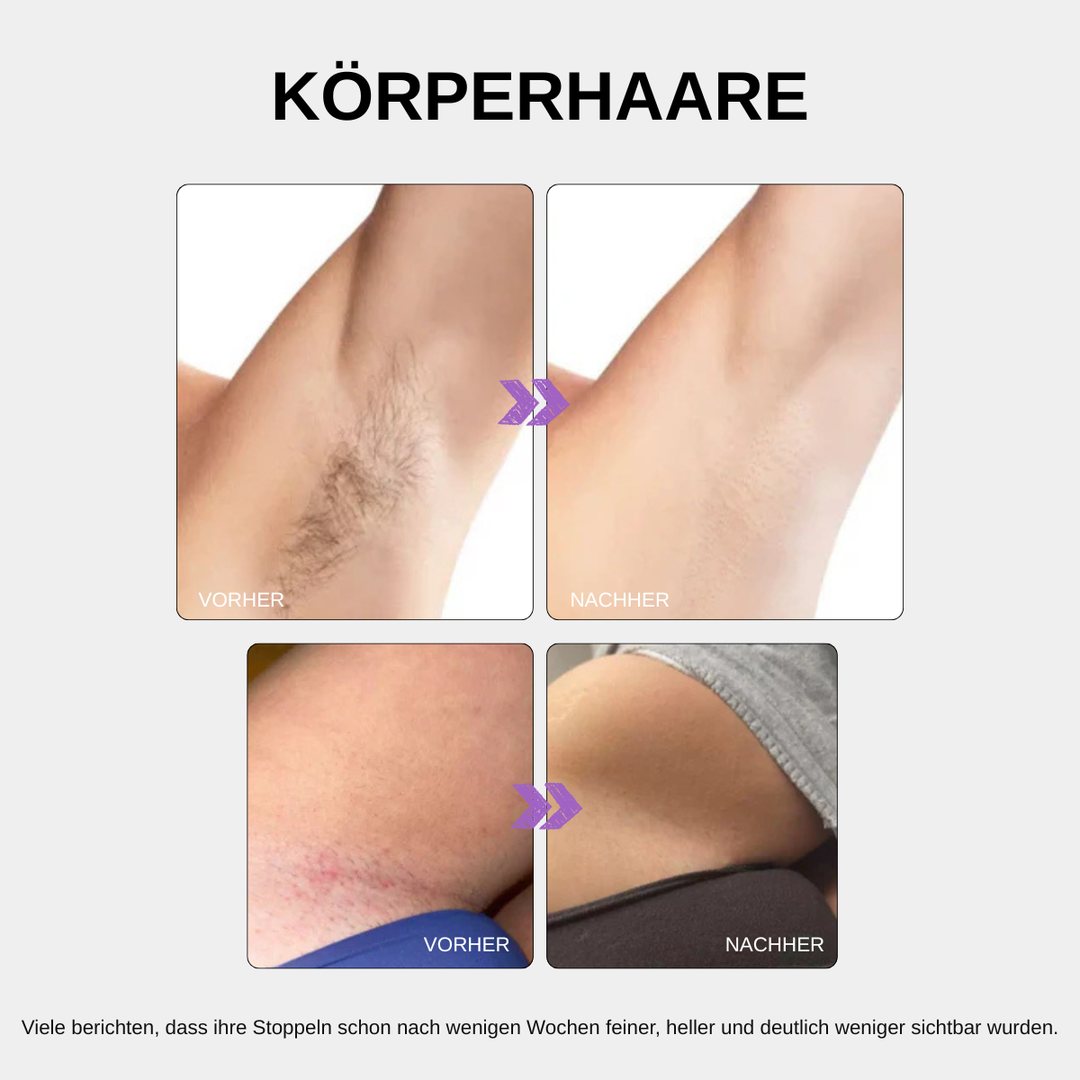 AfterGlow™ Haarwuchs-Reduzierendes Serum