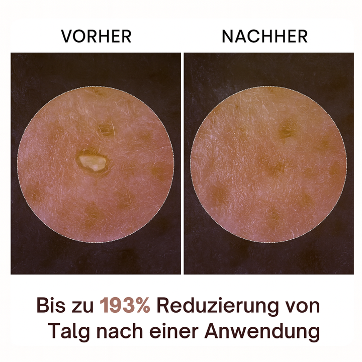 RiceCare™ Peel Serum