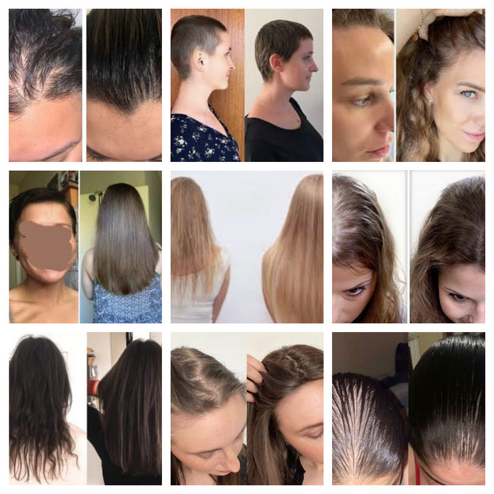 Batana natürliches Haarwuchs Öl